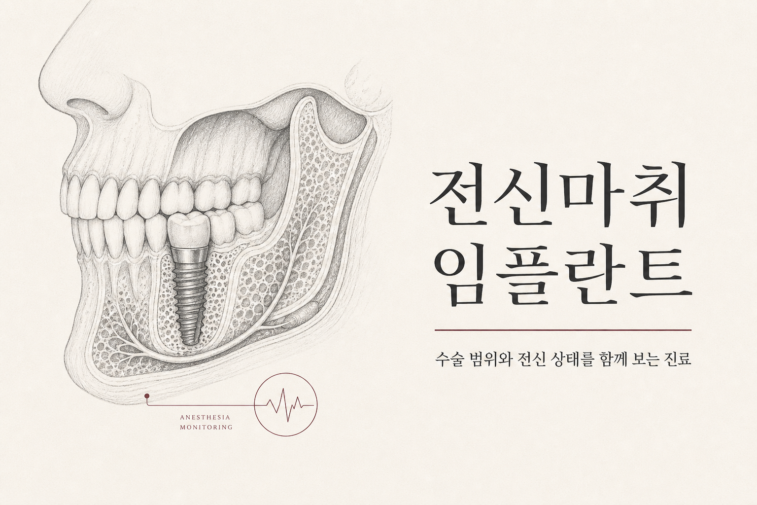 전신마취 임플란트 흑백 해부학 썸네일